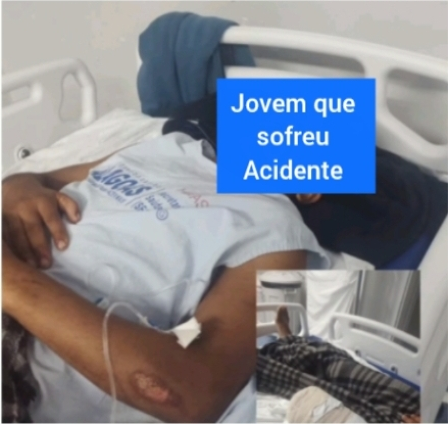 Jovem perde perna em grave acidente de motocicleta no sertão de Alagoas