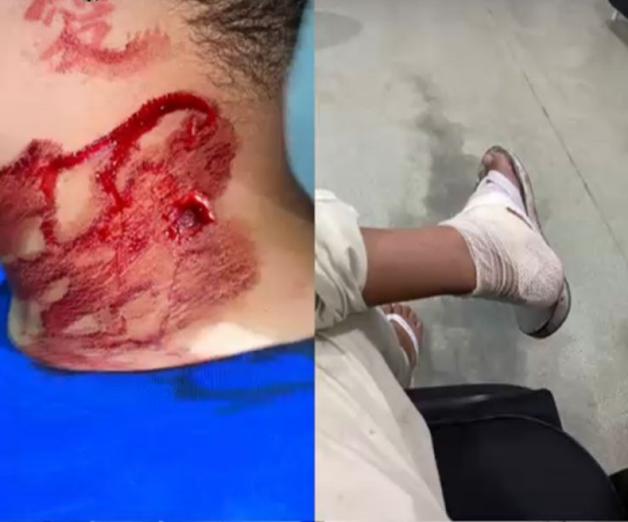 Jovem é violentamente agredido e sofre tentativa de homicídio por ex-namorado em Delmiro Gouveia