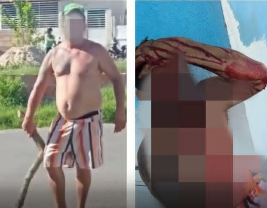Homem vai cobrar dívida com pedaço de madeira; ameaça o devedor e acabou sendo espancado
