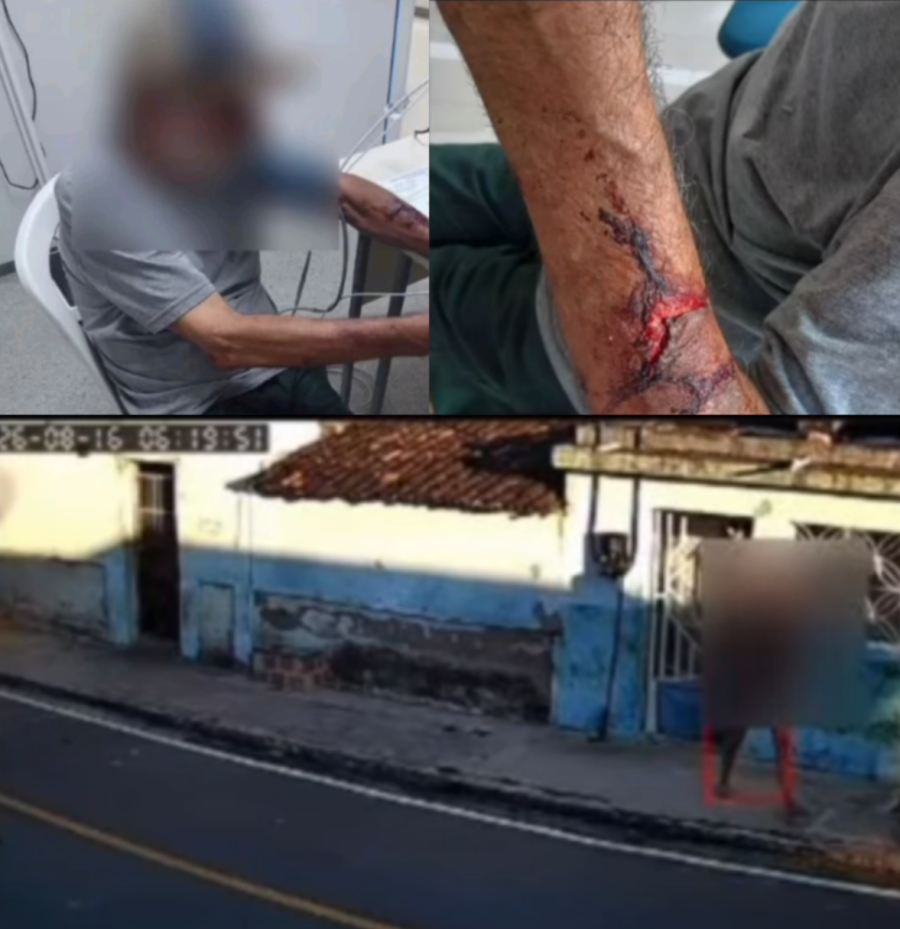Violência contra idoso: mulher invade residência, espanca vítima com capacete e rouba R$ 10 mil no Sertão